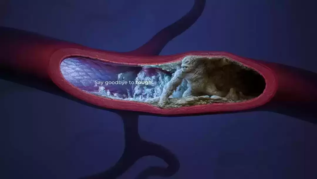 视觉革命：引爆创意的平面广告案例深度解析